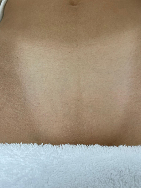 bautifulaura_kosmetik_haarentfernung_muenchen-16